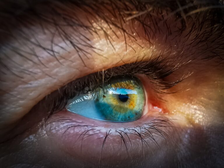 Strong Eyes